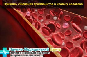 Пародонтоз: фото, симптомы Пародонтоз: фото, симптомы