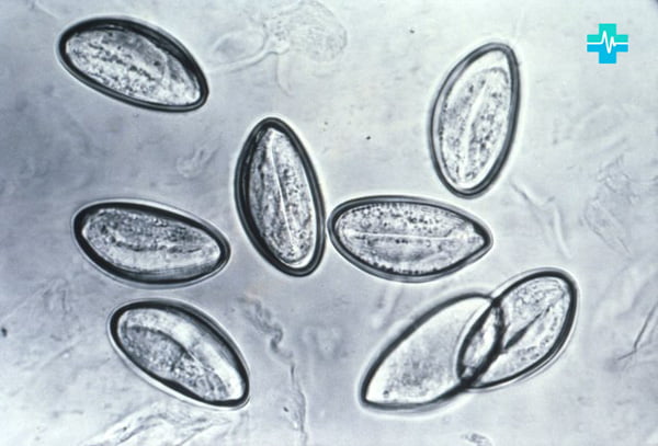 Яйца острицы через микроскоп - фото на gemoparazit.ru