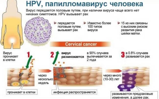 Выделения при вирусе папилломы человека