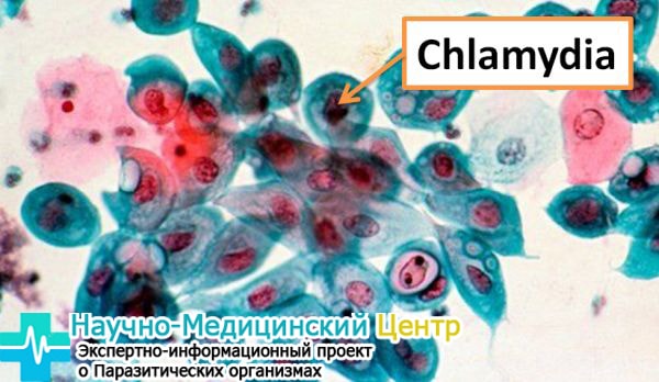 Диагностика chlamydia - изображение на gemoparazit.ru