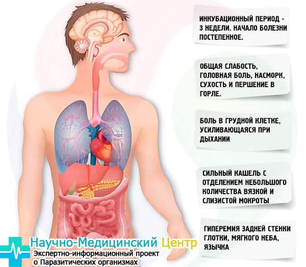 Хламидийная пневмония симптомы у взрослых