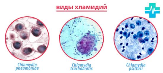 Виды хламидий - фото на Хламидиоз igg - фото на gemoparazit.ru
