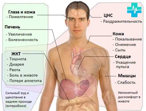 Признаки заражения паразитами - картинка на gemoparazit.ru