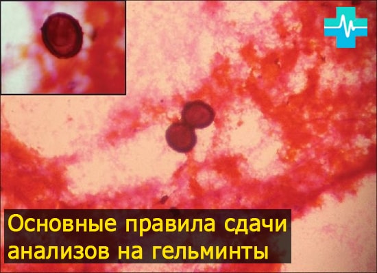 Анализы для выявления глистов - gemoparazit.ru