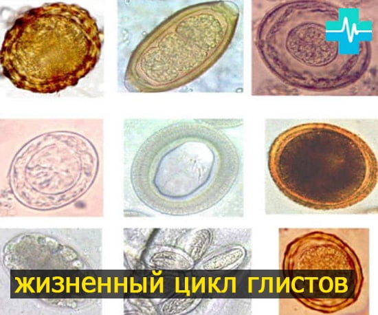 Сколько живут яйца глистов - картинка на gemoparazit.ru