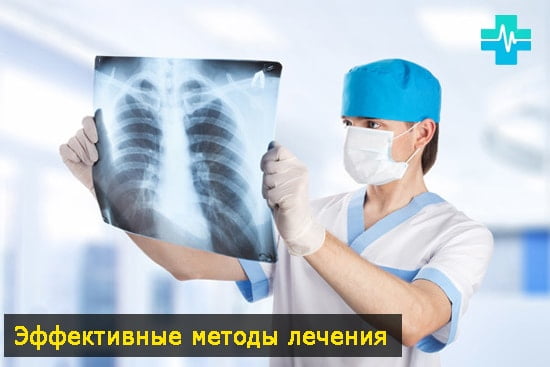 Эффективные методы лечения паразитов - картинка на gemoparazit.ru