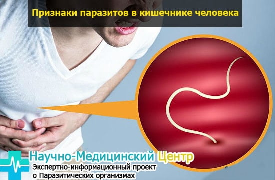 Симптомы заражения паразитами - фото на https://gemoparazit.ru