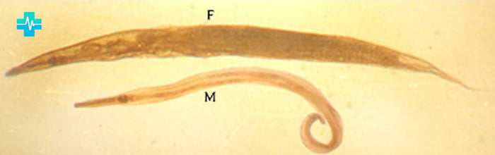 E. vermicularis. Женская (F) и мужская (M) особи - картинка на gemoparazit.ru