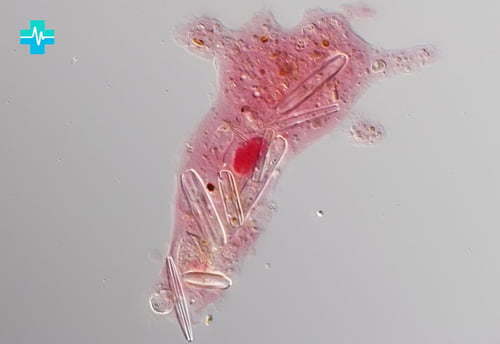 Amoeba proteus переваривает диатомею - изображение на gemoparazit.ru