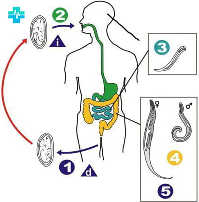 Жизненный цикл развития Энтеробиус Вермикулярис внутри и снаружи человеческого тела - фото | gemoparazit.ru